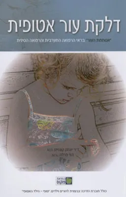 דלקת עור אטופית