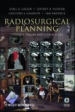 Radiosurgical Planning: Gamma Tricks and Cyber Picks