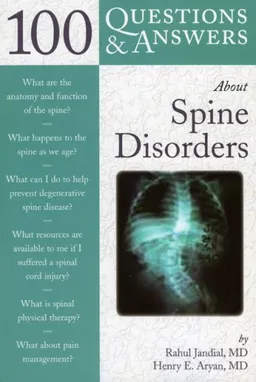 100 Questions & Answers About Spine Disorders (100 Questions & Answers about)