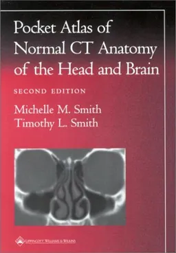 A Pocket Atlas of Normal CT Anatomy of the Head and Brain (Radiology Pocket Atlas Series)