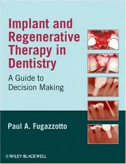 Implant and Regenerative Therapy in Dentistry: A Guide to Decision Making