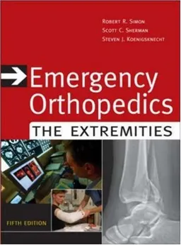 Emergency Orthopedics: The Extremities (Emergency Orthopedics: The Extremities (Simon))
