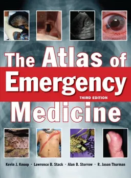 עטיפת הספר The Atlas of Emergency Medicine, Third Edition מאת Kevin Knoop