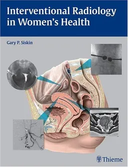 Interventional Radiology in Women's Health