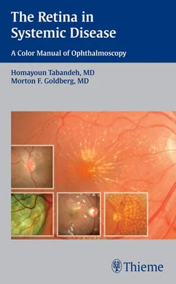 The The Retina in Systemic Disease: A Color Manual of Ophthalmoscopy