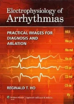 Electrophysiology of Arrhythmias: Practical Images for Diagnosis and Ablation