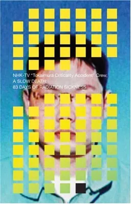 A Slow Death: 83 Days of Radiation Sickness