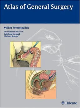 Atlas of General Surgery