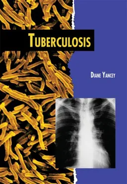 Tuberculosis (Twenty-First Century Medical Library)
