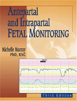 Antepartal and Intrapartal Fetal Monitoring: Third Edition