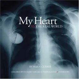 עטיפת הספר My Heart vs. the Real World: Children with Heart Disease, In Photographs & Interviews מאת Max S. Gerber
