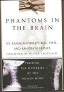 Phantoms in the Brain